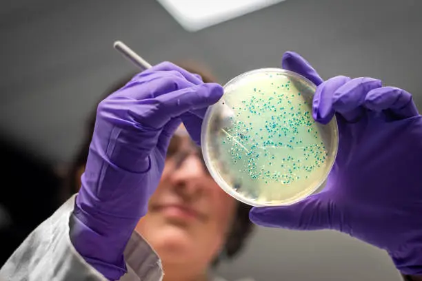 Microbiology Test for Cancer: Diagnosis, Risks and Treatment