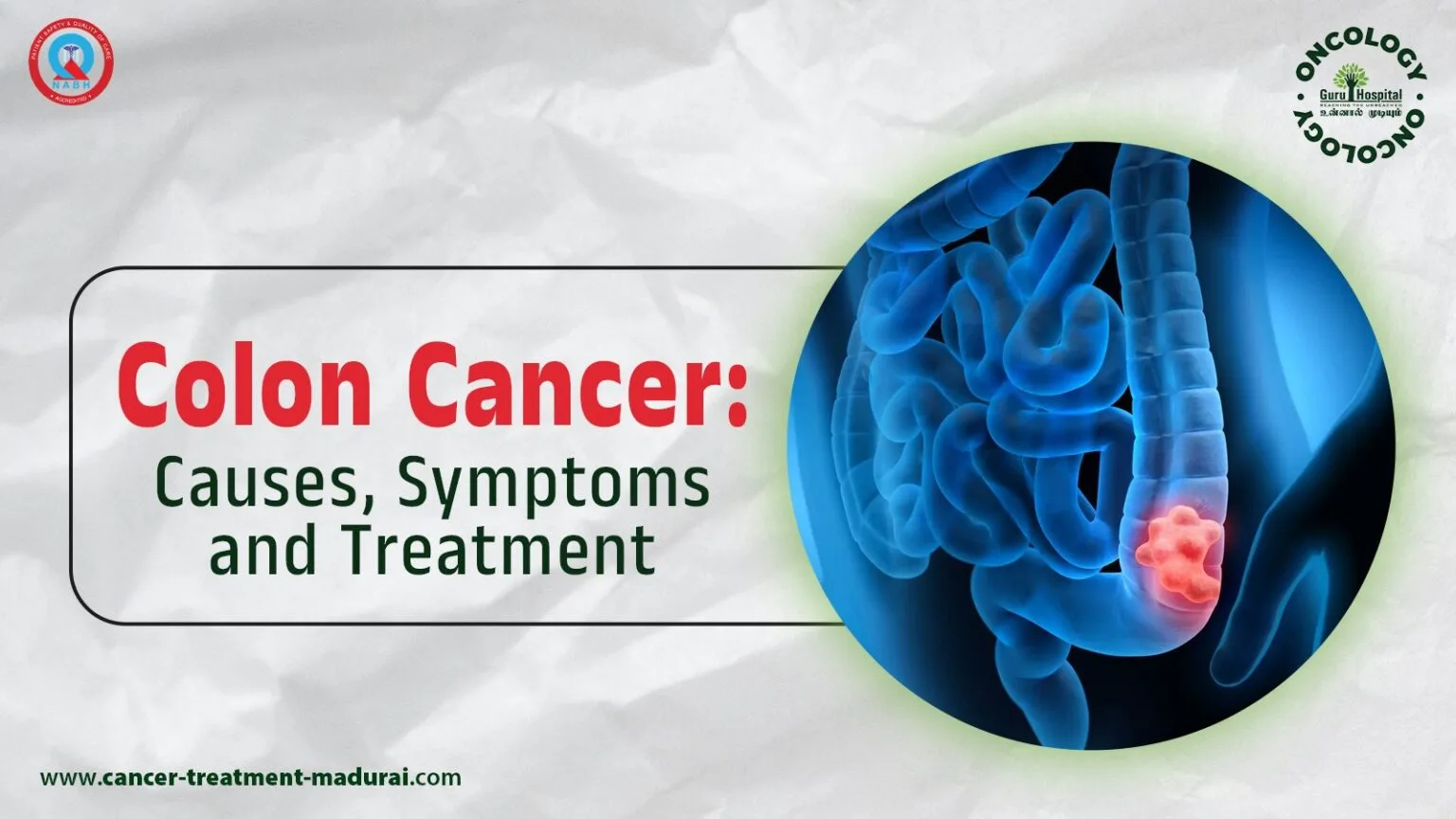 Colon Cancer: Causes, Symptoms, and Treatment